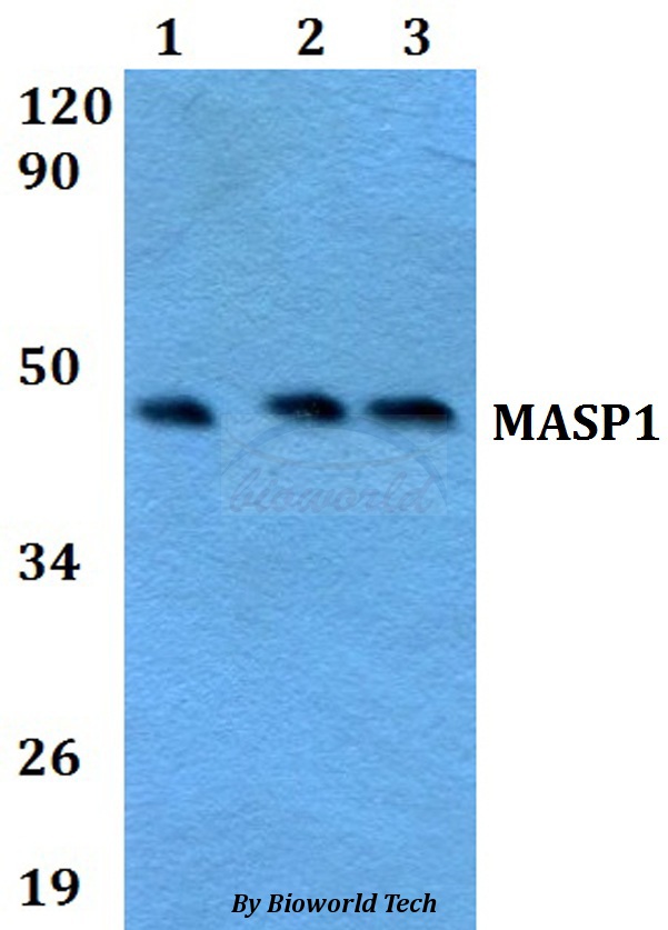 MASP1 / MASP Antibody - Western blot of MASP1 antibody at 1:500 dilution. Lane 1: HEK293T whole cell lysate. Lane 2: Raw264.7 whole cell lysate. Lane 3: H9C2 whole cell lysate.