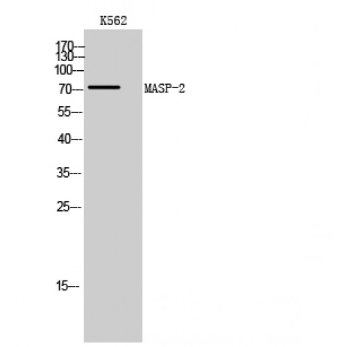 MASP2 / MASP-2 Antibody - Western blot of MASP-2 antibody