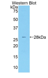MASP2 / MASP-2 Antibody - Western blot of recombinant MASP2 / MASP-2.  This image was taken for the unconjugated form of this product. Other forms have not been tested.