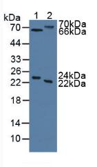 MASP2 / MASP-2 Antibody - Western Blot; Sample: Lane1: Human Serum; Lane2: Rat Liver Tissue.