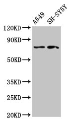 MASP2 / MASP-2 Antibody - Positive Western Blot detected in A549 whole cell lysate, SH-SY5Y whole cell lysate. All lanes: MASP2 antibody at 2.7 µg/ml Secondary Goat polyclonal to rabbit IgG at 1/50000 dilution. Predicted band size: 76, 21 KDa. Observed band size: 76 KDa