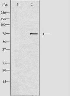 MASP2 / MASP-2 Antibody - Western blot analysis of extracts of K562 cells using MASP2 antibody. The lane on the left is treated with the antigen-specific peptide.