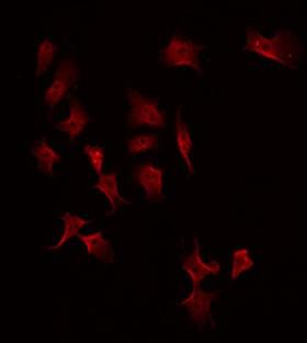 MASP2 / MASP-2 Antibody - Staining HeLa cells by IF/ICC. The samples were fixed with PFA and permeabilized in 0.1% Triton X-100, then blocked in 10% serum for 45 min at 25°C. The primary antibody was diluted at 1:200 and incubated with the sample for 1 hour at 37°C. An Alexa Fluor 594 conjugated goat anti-rabbit IgG (H+L) Ab, diluted at 1/600, was used as the secondary antibody.