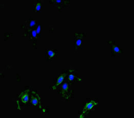 MAST1 Antibody - Immunofluorescent analysis of HeLa cells diluted at 1:100 and Alexa Fluor 488-congugated AffiniPure Goat Anti-Rabbit IgG(H+L)