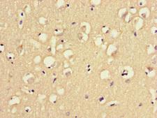 MAST1 Antibody - Immunohistochemistry of paraffin-embedded human brain tissue at dilution of 1:100