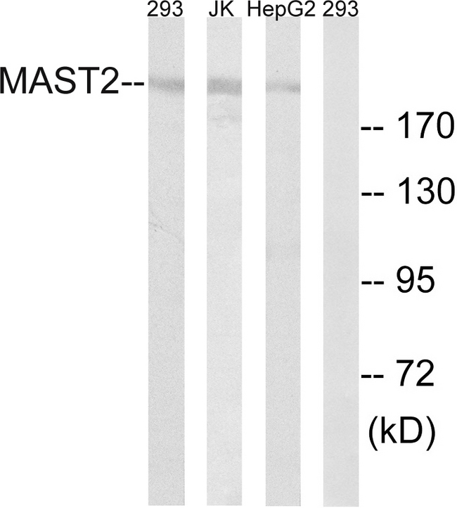 MAST205 / MAST2 Antibody - Western blot analysis of lysates from Jurkat, 293, and HepG2 cells, using MAST2 Antibody. The lane on the right is blocked with the synthesized peptide.