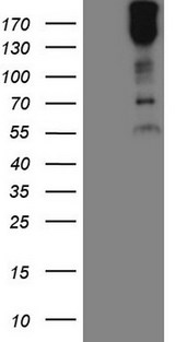 MAST205 / MAST2 Antibody - HEK293T cells were transfected with the pCMV6-ENTRY control. (Left lane) or pCMV6-ENTRY MAST2. (Right lane) cDNA for 48 hrs and lysed. Equivalent amounts of cell lysates. (5 ug per lane) were separated by SDS-PAGE and immunoblotted with anti-MAST2. (1:2000)