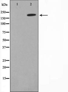 MAST205 / MAST2 Antibody - Western blot analysis on Jurkat cell lysates using MAST2 antibody. The lane on the left is treated with the antigen-specific peptide.