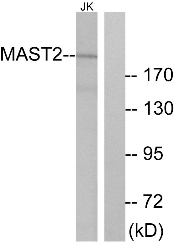 MAST205 / MAST2 Antibody - Western blot analysis of extracts from Jurkat cells, using MAST2 antibody.
