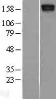 MAST205 / MAST2 Protein - Western validation with an anti-DDK antibody * L: Control HEK293 lysate R: Over-expression lysate