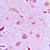 MAST3 Antibody - Immunohistochemical analysis of MAST3 staining in human brain formalin fixed paraffin embedded tissue section. The section was pre-treated using heat mediated antigen retrieval with sodium citrate buffer (pH 6.0). The section was then incubated with the antibody at room temperature and detected using an HRP conjugated compact polymer system. DAB was used as the chromogen. The section was then counterstained with hematoxylin and mounted with DPX.