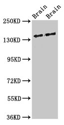MAST3 Antibody - Positive Western Blot detected in Rat brain tissue, Mouse brain tissue. All lanes: MAST3 antibody at 3 µg/ml Secondary Goat polyclonal to rabbit IgG at 1/50000 dilution. Predicted band size: 144 KDa. Observed band size: 144 KDa