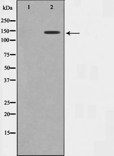 MAST3 Antibody - Western blot analysis on Jurkat cell lysates using MAST3 antibody. The lane on the left is treated with the antigen-specific peptide.