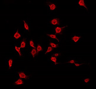 MAST3 Antibody - Staining HeLa cells by IF/ICC. The samples were fixed with PFA and permeabilized in 0.1% Triton X-100, then blocked in 10% serum for 45 min at 25°C. The primary antibody was diluted at 1:200 and incubated with the sample for 1 hour at 37°C. An Alexa Fluor 594 conjugated goat anti-rabbit IgG (H+L) Ab, diluted at 1/600, was used as the secondary antibody.