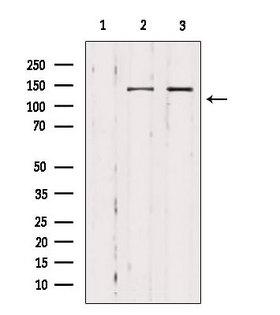 MAST3 Antibody - Western blot analysis of extracts of various samples using MAST3 antibody. Lane 1: B16F10 treated with blocking peptide. Lane 2: B16F10; Lane 3: 293;
