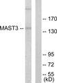 MAST3 Antibody - Western blot analysis of extracts from Jurkat cells, using MAST3 antibody.