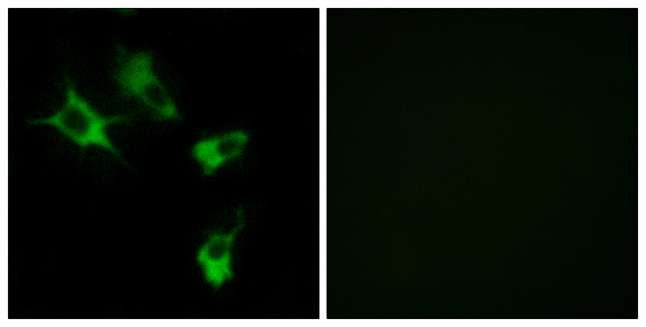 MAST4 Antibody - Immunofluorescence analysis of COS7 cells, using MAST4 Antibody. The picture on the right is blocked with the synthesized peptide.
