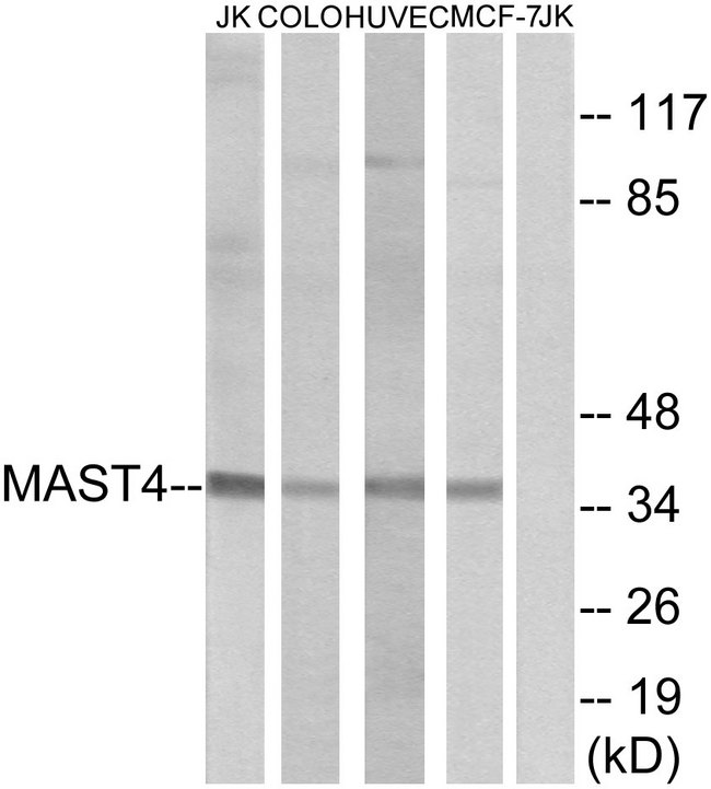 MAST4 Antibody - Western blot analysis of lysates from Jurkat, COLO, HUVEC, and MCF-7 cells, using MAST4 Antibody. The lane on the right is blocked with the synthesized peptide.