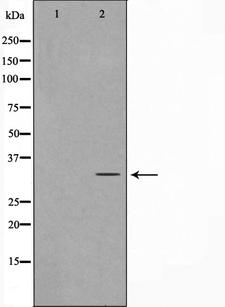 MAST4 Antibody - Western blot analysis on Jurkat cell lysates using MAST4 antibody. The lane on the left is treated with the antigen-specific peptide.