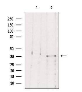 MAST4 Antibody - Western blot analysis of extracts of B16F10 cells using MAST4 antibody. Lane 1 was treated with the blocking peptide.