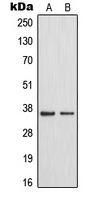 MAST4 Antibody - Western blot analysis of MAST4 expression in HeLa (A); HUVEC (B) whole cell lysates.