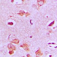 MAST4 Antibody - Immunohistochemical analysis of MAST4 staining in human brain formalin fixed paraffin embedded tissue section. The section was pre-treated using heat mediated antigen retrieval with sodium citrate buffer (pH 6.0). The section was then incubated with the antibody at room temperature and detected using an HRP conjugated compact polymer system. DAB was used as the chromogen. The section was then counterstained with hematoxylin and mounted with DPX.