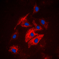 MAST4 Antibody - Immunofluorescent analysis of MAST4 staining in HUVEC cells. Formalin-fixed cells were permeabilized with 0.1% Triton X-100 in TBS for 5-10 minutes and blocked with 3% BSA-PBS for 30 minutes at room temperature. Cells were probed with the primary antibody in 3% BSA-PBS and incubated overnight at 4 C in a humidified chamber. Cells were washed with PBST and incubated with a DyLight 594-conjugated secondary antibody (red) in PBS at room temperature in the dark. DAPI was used to stain the cell nuclei (blue).