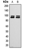 MASTL / GW Antibody - Western blot analysis of GW expression in HeLa (A); U2OS (B) whole cell lysates.