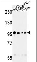 MASTL / GW Antibody - Western blot of MASTL Antibody in HepG2, MDA-MB231, 293, HeLa cell line lysates (35 ug/lane). MASTL (arrow) was detected using the purified antibody.