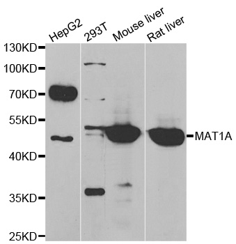 MAT / MAT1A Antibody - Western blot analysis of extracts of various cell lines.