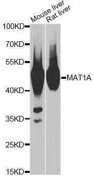 MAT / MAT1A Antibody - Western blot analysis of extracts of various cell lines, using MAT1A antibody at 1:1000 dilution. The secondary antibody used was an HRP Goat Anti-Rabbit IgG (H+L) at 1:10000 dilution. Lysates were loaded 25ug per lane and 3% nonfat dry milk in TBST was used for blocking. An ECL Kit was used for detection and the exposure time was 3s.