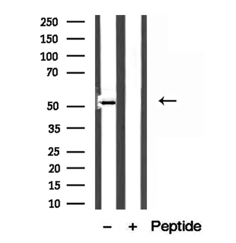MAT / MAT1A Antibody - Western blot analysis of extracts of mouse liver tissue using MAT1A antibody.