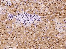 MAT / MAT1A Antibody - Immunochemical staining of human MAT1A in human liver with rabbit polyclonal antibody at 1:200 dilution, formalin-fixed paraffin embedded sections.