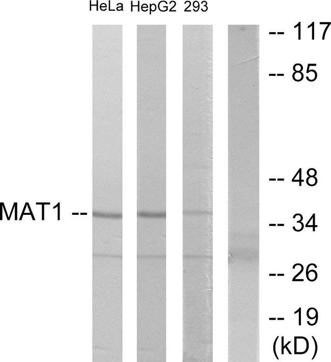 MAT / MAT1A Antibody - Western blot analysis of extracts from HeLa cells, HepG2 cells and 293 cells, using MAT1 antibody.