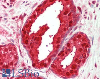 MAT2A Antibody - Human Prostate: Formalin-Fixed, Paraffin-Embedded (FFPE).  This image was taken for the unconjugated form of this product. Other forms have not been tested.