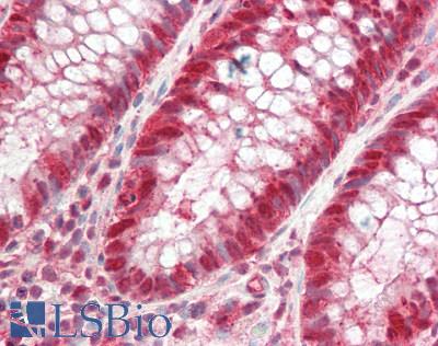 MAT2A Antibody - Human Colon: Formalin-Fixed, Paraffin-Embedded (FFPE).  This image was taken for the unconjugated form of this product. Other forms have not been tested.