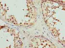 MAT2A Antibody - Immunohistochemistry of paraffin-embedded human testis tissue using antibody at dilution of 1:100.