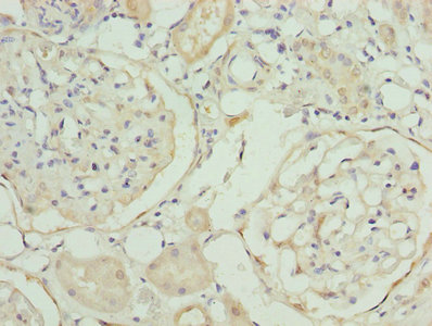 MAT2A Antibody - Immunohistochemistry of paraffin-embedded human kidney tissue using MAT2A Antibody at dilution of 1:100