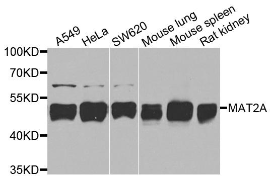 MAT2A Antibody - Western blot analysis of extracts of various cells.
