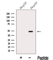 MAT2A Antibody - Western blot analysis of extracts of HepG2 cells using MAT2A antibody. The lane on the left was treated with blocking peptide.