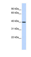 MAT2B Antibody - MAT2B antibody Western blot of Fetal Lung lysate. This image was taken for the unconjugated form of this product. Other forms have not been tested.