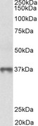 MAT2B Antibody - MAT2B antibody (0.3 ug/ml) staining of Human Thymus lysate (35 ug protein in RIPA buffer). Primary incubation was 1 hour. Detected by chemiluminescence.