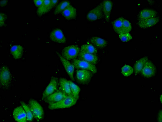 MAT2B Antibody - Immunofluorescent analysis of HepG2 cells using MAT2B Antibody at a dilution of 1:100 and Alexa Fluor 488-congugated AffiniPure Goat Anti-Rabbit IgG(H+L)