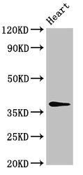 MAT2B Antibody - Western Blot Positive WB detected in: Rat heart tissue All lanes: MAT2B antibody at 4µg/ml Secondary Goat polyclonal to rabbit IgG at 1/50000 dilution Predicted band size: 38, 37, 29, 35, 10 kDa Observed band size: 38 kDa