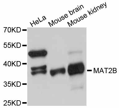 MAT2B Antibody - Western blot analysis of extracts of various cell lines, using MAT2B antibody at 1:3000 dilution. The secondary antibody used was an HRP Goat Anti-Rabbit IgG (H+L) at 1:10000 dilution. Lysates were loaded 25ug per lane and 3% nonfat dry milk in TBST was used for blocking. An ECL Kit was used for detection and the exposure time was 30s.
