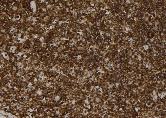 MAT2B Antibody - 1:100 staining mouse spleen tissue by IHC-P. The sample was formaldehyde fixed and a heat mediated antigen retrieval step in citrate buffer was performed. The sample was then blocked and incubated with the antibody for 1.5 hours at 22°C. An HRP conjugated goat anti-rabbit antibody was used as the secondary.