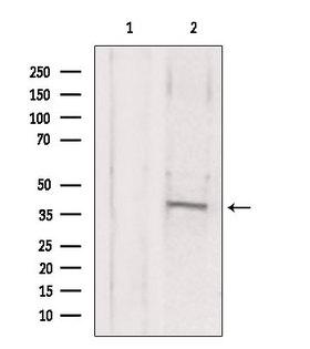 MAT2B Antibody - Western blot analysis of extracts of mouse brain tissue using MAT2B antibody. Lane 1 was treated with the blocking peptide.