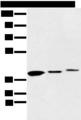 MAT2B Antibody - Western blot analysis of 231 cell Human fetal liver and Human fetal brain tissue  using MAT2B Polyclonal Antibody at dilution of 1:500