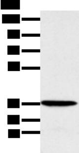 MAT2B Antibody - Western blot analysis of Human fetal liver tissue  using MAT2B Polyclonal Antibody at dilution of 1:1000