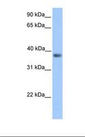 MATH2 / NEUROD6 Antibody - Transfected 293T cell lysate. Antibody concentration: 1.0 ug/ml. Gel concentration: 12%.  This image was taken for the unconjugated form of this product. Other forms have not been tested.